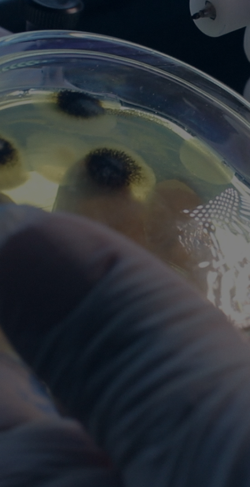 ANÁLISES DE MICRORGANISMOS DO SOLO